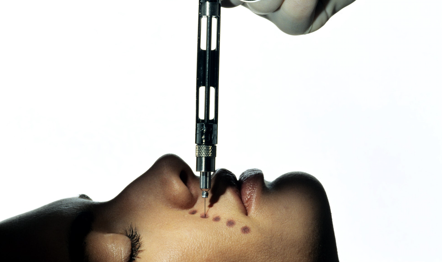 Jena’s Top 3 Lasers and Procedures For Ageless Skin