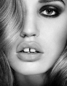 Wisdom Teeth And Extractions
