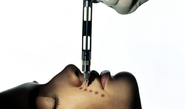 Jena’s Top 3 Lasers and Procedures For Ageless Skin