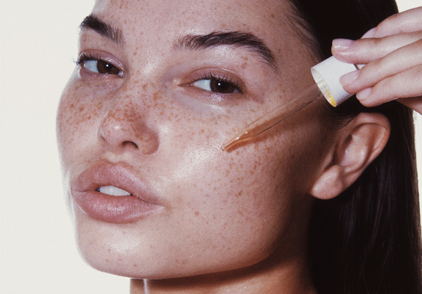 Two experts weigh in on melasma